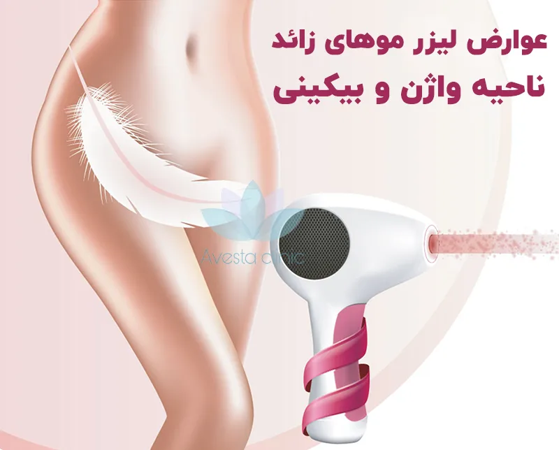 عوارض لیزر موهای زائد واژن
