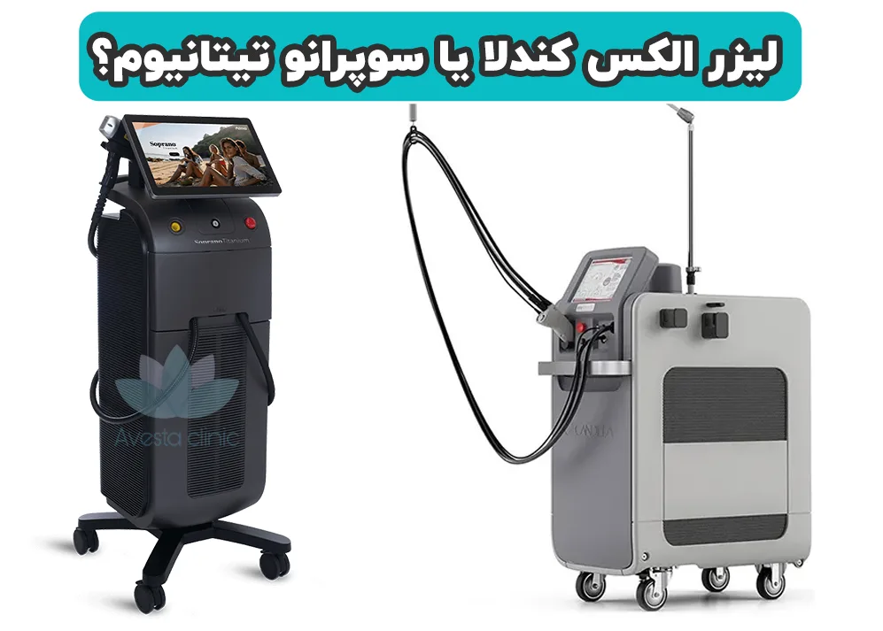 لیزر الکس کندلا یا سوپرانو تیتانیوم؟