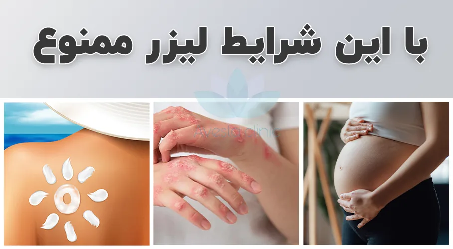 شرایط ممنوع لیزر