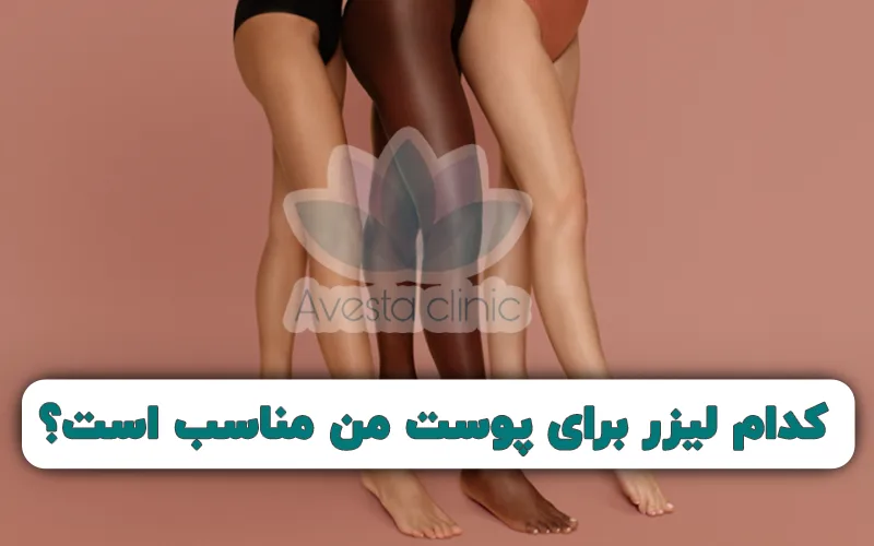 کدام لیزر برای پوست من مناسب است؟