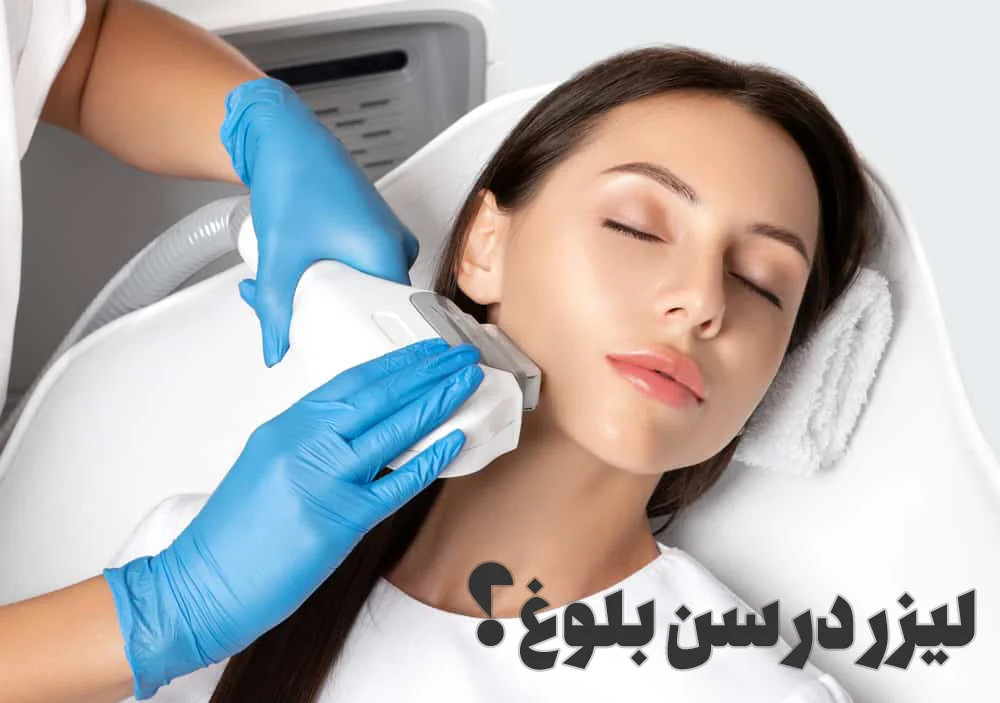 لیزر در سن بلوغ