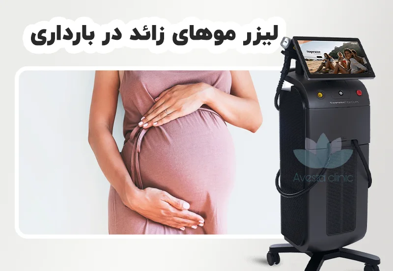 لیزر موهای زائد در دوران بارداری