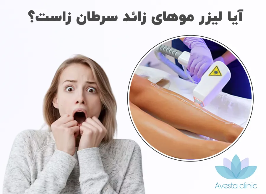 آیا لیزر موهای زائد سرطان زاست؟